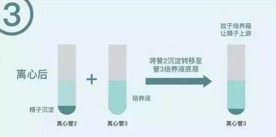 胚胎着床