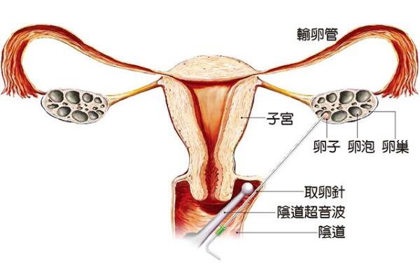 胚胎着床腹痛
