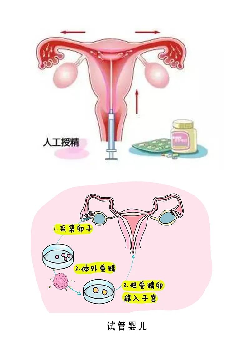 胚胎着床出血