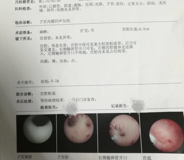 胚胎着床