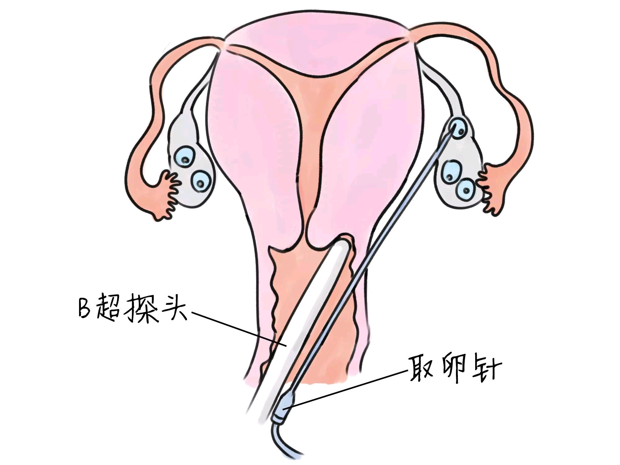 胚胎着床