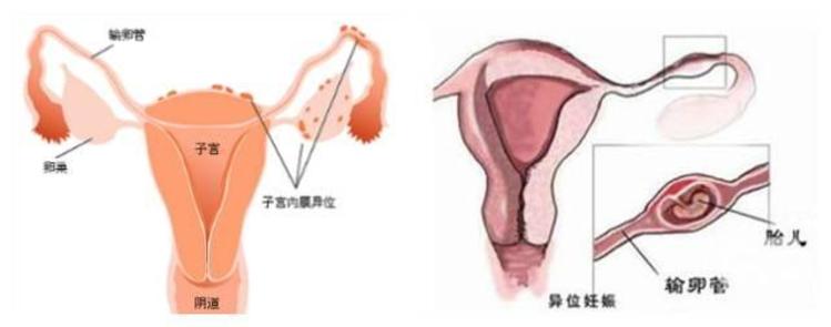 胚胎着床
