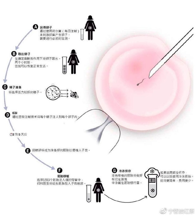 胚胎着床出血