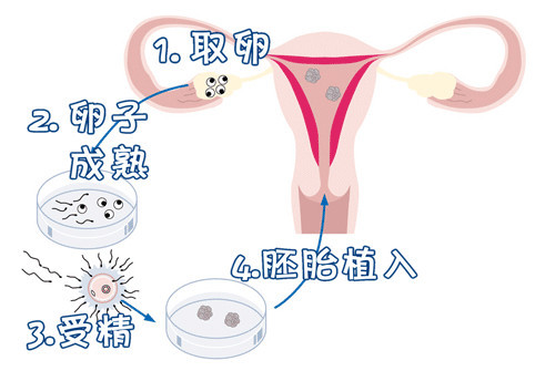胚胎着床
