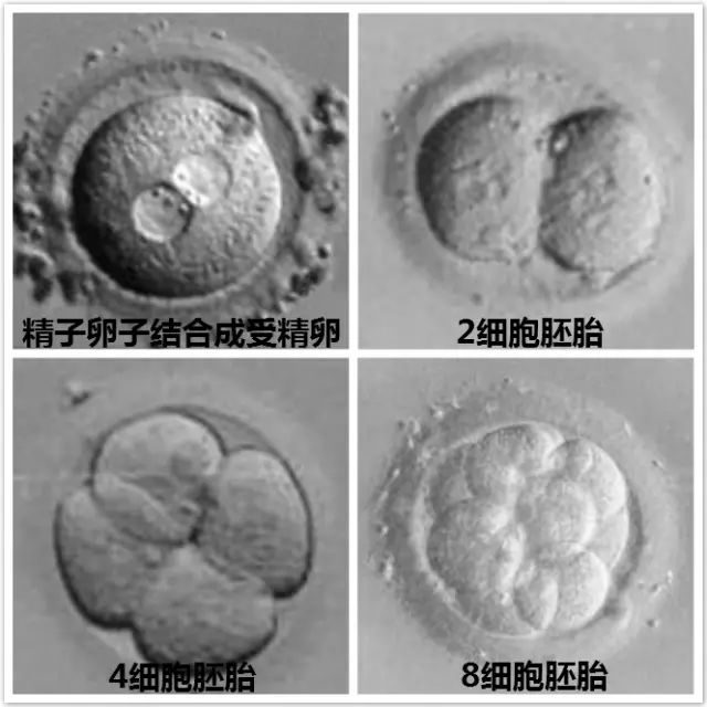 胚胎着床出血