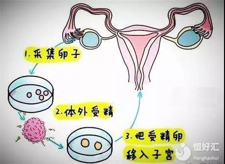 胚胎着床